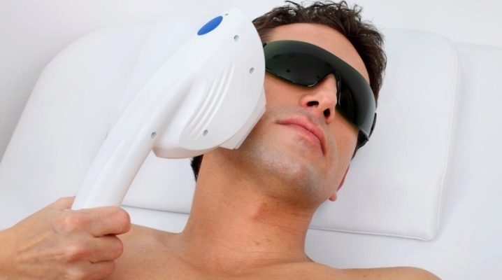 Видове епилация на мъже и правила за подготовка за нея